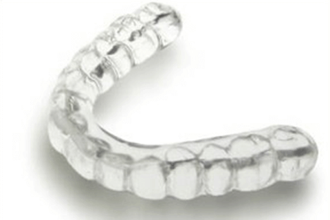 佐賀市の歯医者、佐賀ん歯科・こども歯科で歯ぎしりの治療