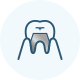 佐賀市の歯医者、佐賀ん歯科・こども歯科でむし歯治療
