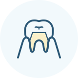 佐賀市の歯医者、佐賀ん歯科・こども歯科でむし歯治療
