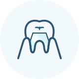 佐賀市の歯医者、佐賀ん歯科・こども歯科でむし歯治療