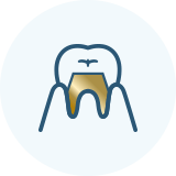 佐賀市の歯医者、佐賀ん歯科・こども歯科でむし歯治療