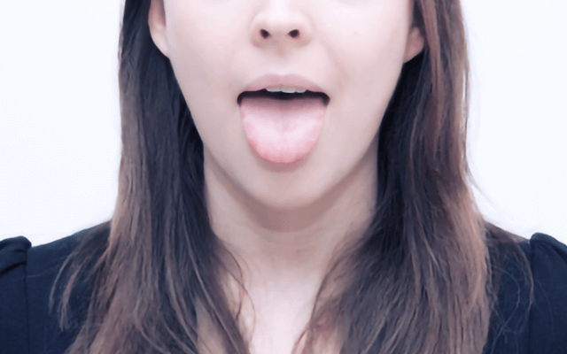 佐賀市の歯医者、佐賀ん歯科・こども歯科で舌痛症の治療