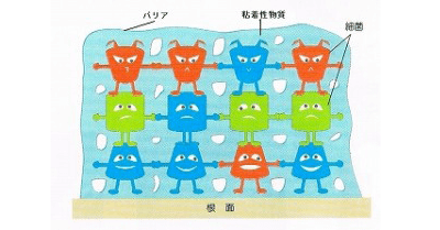 佐賀市の歯医者、佐賀ん歯科・こども歯科の口臭専門外来