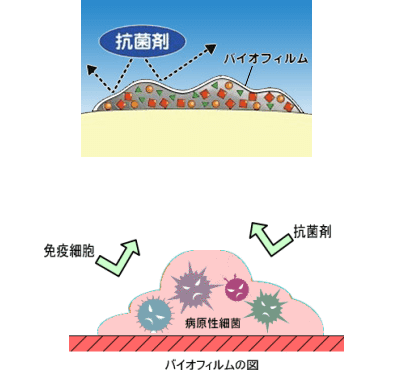 佐賀市の歯医者、佐賀ん歯科・こども歯科の口臭専門外来