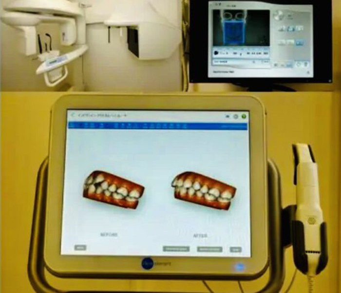 佐賀市の歯医者、佐賀ん歯科・こども歯科で矯正歯科