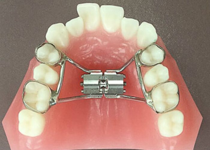 佐賀市の歯医者、佐賀ん歯科・こども歯科で矯正歯科