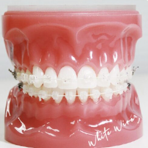 佐賀市の歯医者、佐賀ん歯科・こども歯科で矯正歯科