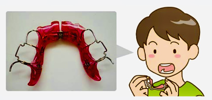 佐賀市の歯医者、佐賀ん歯科・こども歯科で矯正歯科