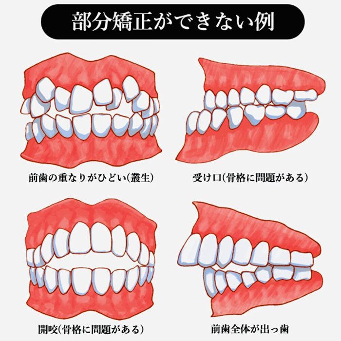 佐賀市の歯医者、佐賀ん歯科・こども歯科で矯正歯科