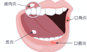 佐賀市の歯医者、佐賀ん歯科・こども歯科で無痛治療