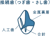 佐賀市の歯医者、佐賀ん歯科・こども歯科の料金表