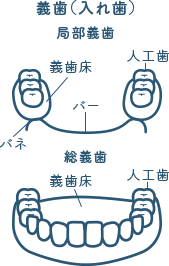 佐賀市の歯医者、佐賀ん歯科・こども歯科の料金表