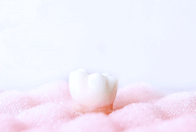 佐賀市の歯医者、佐賀ん歯科・こども歯科で親知らずの抜歯